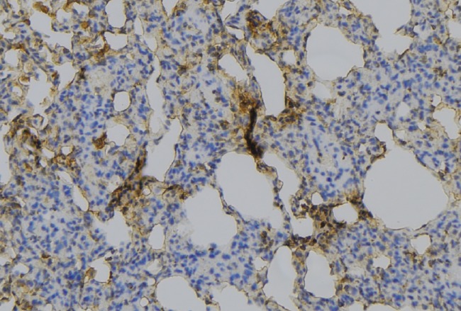 Mannose Receptor / CD206 Antibody - 1:100 staining mouse lung tissue by IHC-P. The sample was formaldehyde fixed and a heat mediated antigen retrieval step in citrate buffer was performed. The sample was then blocked and incubated with the antibody for 1.5 hours at 22°C. An HRP conjugated goat anti-rabbit antibody was used as the secondary.