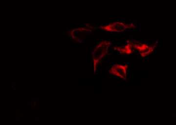 Mannose Receptor / CD206 Antibody - Staining HeLa cells by IF/ICC. The samples were fixed with PFA and permeabilized in 0.1% Triton X-100, then blocked in 10% serum for 45 min at 25°C. The primary antibody was diluted at 1:200 and incubated with the sample for 1 hour at 37°C. An Alexa Fluor 594 conjugated goat anti-rabbit IgG (H+L) antibody, diluted at 1/600, was used as secondary antibody.