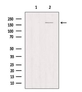 Mannose Receptor / CD206 Antibody - Western blot analysis of extracts of Myeloma cells using MRC1 antibody. Lane 1 was treated with the antigen-specific peptide.