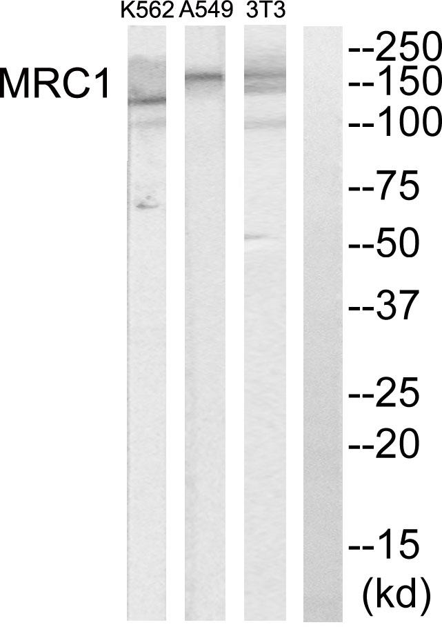 Mannose Receptor / CD206 Antibody - Western blot analysis of extracts from K562 cells, A549 cells and NIH-3T3 cells, using MRC1 antibody.