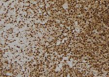 MANSC1 Antibody - 1:100 staining human spleen tissue by IHC-P. The sample was formaldehyde fixed and a heat mediated antigen retrieval step in citrate buffer was performed. The sample was then blocked and incubated with the antibody for 1.5 hours at 22°C. An HRP conjugated goat anti-rabbit antibody was used as the secondary.