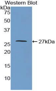 MAOA / Monoamine Oxidase Antibody - Western blot of recombinant MAOA / Monoamine Oxidase.  This image was taken for the unconjugated form of this product. Other forms have not been tested.