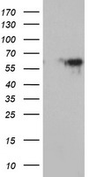 MAOA / Monoamine Oxidase Antibody - HEK293T cells were transfected with the pCMV6-ENTRY control (Left lane) or pCMV6-ENTRY MAOA (Right lane) cDNA for 48 hrs and lysed. Equivalent amounts of cell lysates (5 ug per lane) were separated by SDS-PAGE and immunoblotted with anti-MAOA.