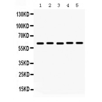 MAOA / Monoamine Oxidase Antibody - MAOA antibody Western blot. All lanes: Anti MAOA at 0.5 ug/ml. Lane 1: Rat Kidney Tissue Lysate at 50 ug. Lane 2: Mouse Kidney Tissue Lysate at 50 ug. Lane 3: COLO320 Whole Cell Lysate at 40 ug. Lane 4: HEPG2 Whole Cell Lysate at 40 ug. Lane 5: HEPA Whole Cell Lysate at 40 ug. Predicted band size: 60 kD. Observed band size: 60 kD.