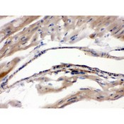 MAOA / Monoamine Oxidase Antibody - MAOA antibody IHC-paraffin. IHC(P): Mouse Cardiac Muscle Tissue.