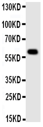 MAOA / Monoamine Oxidase Antibody - Anti-MAOA antibody, Western blotting All lanes: Anti MAOA at 0.5ug/ml WB: Human Placenta Tissue Lysate at 50ug Predicted bind size: 60KD Observed bind size: 60KD