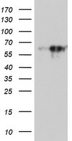 MAOA / Monoamine Oxidase Antibody - HEK293T cells were transfected with the pCMV6-ENTRY control (Left lane) or pCMV6-ENTRY MAOA (Right lane) cDNA for 48 hrs and lysed. Equivalent amounts of cell lysates (5 ug per lane) were separated by SDS-PAGE and immunoblotted with anti-MAOA.