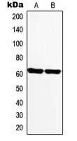MAOA / Monoamine Oxidase Antibody - Western blot analysis of Monoamine Oxidase A expression in PC12 (A); Human heart (B) whole cell lysates.