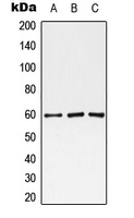 MAOA / Monoamine Oxidase Antibody - Western blot analysis of Monoamine Oxidase A expression in HEK293T (A); Raw264.7 (B); PC12 (C) whole cell lysates.