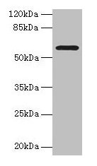 MAOA / Monoamine Oxidase Antibody - Western blot All lanes: MAOA antibody at 6µg/ml Lane 1: Mouse kidney tissue Lane 2: Mouse liver tissue Lane 3: HepG2 whole cell lysate Lane 4: A549 whole cell lysate Secondary Goat polyclonal to rabbit IgG at 1/10000 dilution Predicted band size: 60, 45 kDa Observed band size: 60 kDa