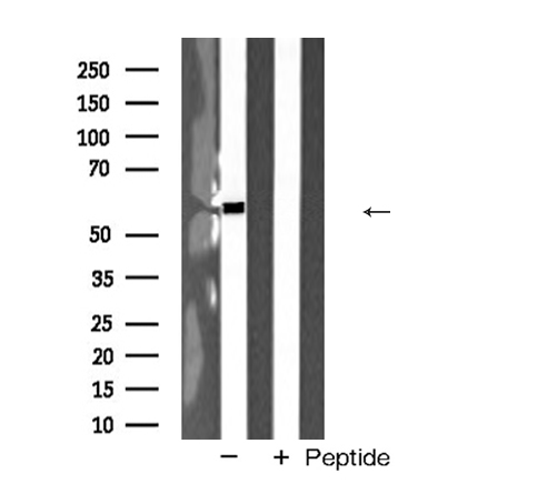 MAOA / Monoamine Oxidase Antibody - Western blot analysis of MAOA expression in HeLa cells extracts