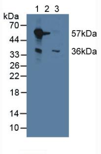 MAOB / Monoamine Oxidase B Antibody - Western Blot; Lane1: Mouse Liver Tissue; Lane2: Mouse Brain Tissue; Lane3: Mouse Kidney Tissue.