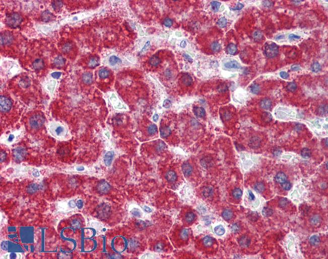 MAOB / Monoamine Oxidase B Antibody - Anti-MAOB antibody IHC of human liver. Immunohistochemistry of formalin-fixed, paraffin-embedded tissue after heat-induced antigen retrieval. Antibody concentration 5 ug/ml.  This image was taken for the unconjugated form of this product. Other forms have not been tested.
