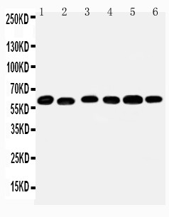 MAOB / Monoamine Oxidase B Antibody - WB of MAOB / Monoamine Oxidase B antibody. All lanes: Anti-MAOB at 0.5ug/ml. Lane 1: Mouse Liver Tissue Lysate at 40ug. Lane 2: Mouse Lung Tissue Lysate at 40ug. Lane 3: Rat Kidney Tissue Lysate at 40ug. Lane 4: Rat Brain Tissue Lysate at 40ug. Lane 5: Rat Liver Tissue Lysate at 40ug. Lane 6: Rat Lung Tissue Lysate at 40ug. Predicted bind size: 59KD. Observed bind size: 59KD.