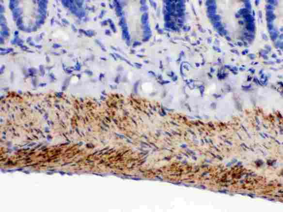 MAOB / Monoamine Oxidase B Antibody - anti-MAOB Picoband antibodyIHC(P): Rat Intestine Tissue