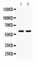 MAOB / Monoamine Oxidase B Antibody - anti-MAOB Picoband antibody Western blotting All lanes: Anti MAOB at 0.5ug/ml Lane 1: Rat Brain Tissue Lysate at 50ug Lane 2: Mouse Brain Tissue Lysate at 50ug Predicted bind size: 59KD Observed bind size: 59KD