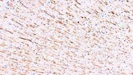 MAP1 Antibody -  This image was taken for the unconjugated form of this product. Other forms have not been tested.