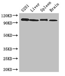 MAP10 / KIAA1383 Antibody - Western Blot Positive WB detected in: U251 whole cell lysate, Mouse liver tissue, Mouse Spleen tissue, Mouse brain tissue All lanes: MAP10 antibody at 3µg/ml Secondary Goat polyclonal to rabbit IgG at 1/50000 dilution Predicted band size: 101 kDa Observed band size: 101 kDa
