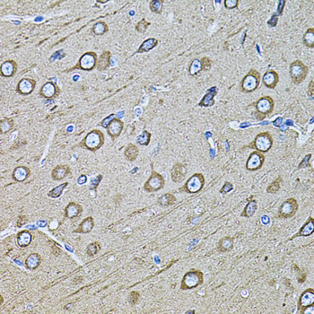MAP1B Antibody - Immunohistochemistry of paraffin-embedded rat brain tissue.