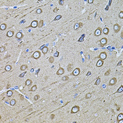 MAP1B Antibody - Immunohistochemistry of paraffin-embedded rat brain tissue.