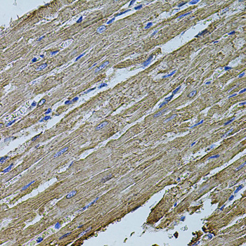MAP1B Antibody - Immunohistochemistry of paraffin-embedded rat heart tissue.