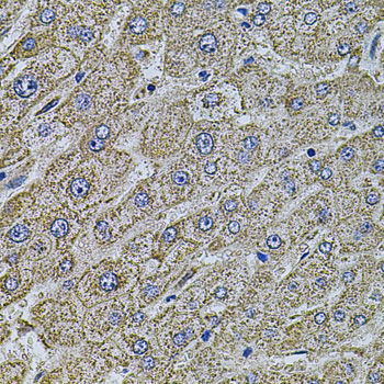 MAP1B Antibody - Immunohistochemistry of paraffin-embedded human liver injury tissue.