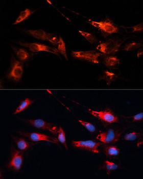 MAP1B Antibody - Immunofluorescence analysis of C6 cells using MAP1B Polyclonal Antibody at dilution of 1:100.Blue: DAPI for nuclear staining.