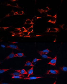 MAP1B Antibody - Immunofluorescence analysis of NIH/3T3 cells using MAP1B Polyclonal Antibody at dilution of 1:100.Blue: DAPI for nuclear staining.