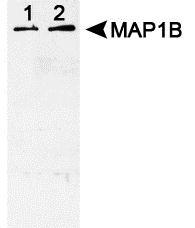 MAP1B Antibody - MAP1B (phospho Thr1265) Antibody Western blot analysis of phosphorylated MAP1B in chick embryos (lane 1) and rat neonatal brain (lane 2).  This image was taken for the unconjugated form of this product. Other forms have not been tested.