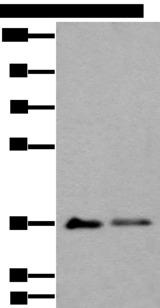 MAP1D Antibody - Western blot analysis of 293T cell lysates  using METAP1D Polyclonal Antibody at dilution of 1:600