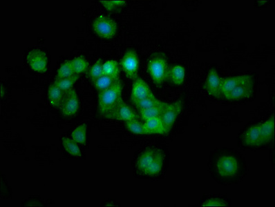 MAP1L / MAP1A Antibody - Immunofluorescence staining of HepG2 cells at a dilution of 1:133, counter-stained with DAPI. The cells were fixed in 4% formaldehyde, permeabilized using 0.2% Triton X-100 and blocked in 10% normal Goat Serum. The cells were then incubated with the antibody overnight at 4 °C.The secondary antibody was Alexa Fluor 488-congugated AffiniPure Goat Anti-Rabbit IgG (H+L) .