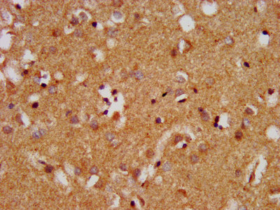 MAP1L / MAP1A Antibody - Immunohistochemistry image at a dilution of 1:400 and staining in paraffin-embedded human brain tissue performed on a Leica BondTM system. After dewaxing and hydration, antigen retrieval was mediated by high pressure in a citrate buffer (pH 6.0) . Section was blocked with 10% normal goat serum 30min at RT. Then primary antibody (1% BSA) was incubated at 4 °C overnight. The primary is detected by a biotinylated secondary antibody and visualized using an HRP conjugated SP system.