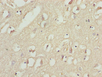 MAP1LC3A / LC3A Antibody - Immunohistochemistry of paraffin-embedded human brain tissue using MAP1LC3A Antibody at dilution of 1:100