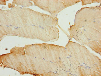MAP1LC3A / LC3A Antibody - Immunohistochemistry of paraffin-embedded human skeletal muscle tissue using MAP1LC3A Antibody at dilution of 1:100
