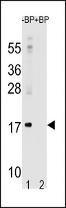 MAP1LC3A / LC3A Antibody - Western blot of anti-LC3 (APG8a) antibody in rat brain lysate. Both lipidated (arrow, II) and non-lipidated APG8a (arrow, I) were detected in membrane fraction (P) but only non-lipidated LC3 was detected in soluble fraction (S).