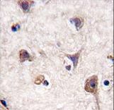 MAP1LC3A / LC3A Antibody - Formalin-fixed and paraffin-embedded human brain tissue reacted with Autophagy LC3 Antibody (APG8a) , which was peroxidase-conjugated to the secondary antibody, followed by DAB staining. This data demonstrates the use of this antibody for immunohistochemistry; clinical relevance has not been evaluated.