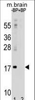 MAP1LC3A / LC3A Antibody - APG8a (MAP1LC3A) Antibody (M1) western blot of mouse brain tissue lysates (35 ug/lane). The APG8a (MAP1LC3A) antibody detected the APG8a (MAP1LC3A) protein (arrow).