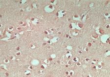 MAP1LC3A / LC3A Antibody - IHC of normal human brain using antibody (APG8) at 5 ug/ml.
