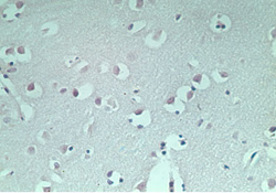 MAP1LC3A / LC3A Antibody - IHC of normal human brain using control (rabbit Ig) at 5 ug/ml.