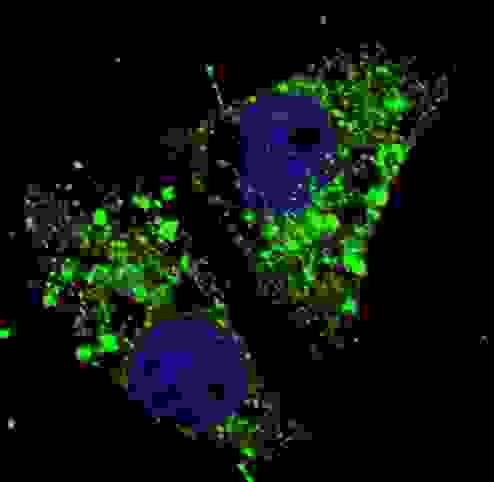 MAP1LC3A / LC3A Antibody - Fluorescent image of U251 cells stained with cleaved LC3A antibody. U251 cells were treated with Chloroquine (50 mu M,16h), then fixed with 4% PFA (20 min), permeabilized with Triton X-100 (0.2%, 30 min). Cells were then incubated cleaved LC3A primary antibody (1:100, 2 h at room temperature). For secondary antibody, Alexa Fluor 488 conjugated donkey anti-rabbit antibody (green) was used (1:1000, 1h). Nuclei were counterstained with Hoechst 33342 (blue) (10 ug/ml, 5 min). LC3 immunoreactivity is localized to autophagic vacuoles in the cytoplasm of U251 cells.