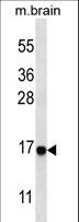 MAP1LC3A / LC3A Antibody - Western blot of anti-cleaved-LC3 (APG8a) antibody in mouse brain tissue lysate. Cleaved-LC3 (APG8a) was detected using the purified antibody.