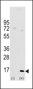 MAP1LC3A / LC3A Antibody - Western blot of LC3 (APG8a) (arrow) using rabbit polyclonal Autophagy LC3 Antibody (APG8a) (D106). 293 cell lysates (2 ug/lane) either nontransfected (Lane 1) or transiently transfected with the LC3 (APG8a) gene (Lane 2) (Origene Technologies).