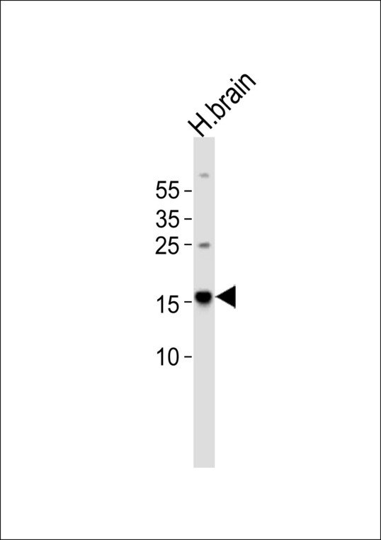 MAP1LC3A / LC3A Antibody - Western blot of lysate from human brain tissue, using DANRE map1lc3a Antibody diluted at 1:1000. A goat anti-rabbit IgG H&L (HRP) at 1:10000 dilution was used as the secondary antibody. Lysate at 20 ug.