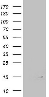 MAP1LC3A / LC3A Antibody - HEK293T cells were transfected with the pCMV6-ENTRY control (Left lane) or pCMV6-ENTRY MAP1LC3A (Right lane) cDNA for 48 hrs and lysed. Equivalent amounts of cell lysates (5 ug per lane) were separated by SDS-PAGE and immunoblotted with anti-MAP1LC3A.