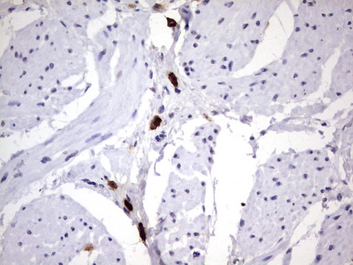 MAP1LC3A / LC3A Antibody - IHC of paraffin-embedded Human bladder tissue using anti-MAP1LC3A mouse monoclonal antibody. (Heat-induced epitope retrieval by 1 mM EDTA in 10mM Tris, pH8.5, 120°C for 3min).