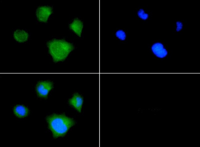 MAP1LC3A / LC3A Antibody - Immunocytochemistry/Immunofluorescence: LC3I Antibody - LC3I antibody was tested in Neuro2a cells with FITC (green). Nuclei were counterstained with DAPI (blue).  This image was taken for the unconjugated form of this product. Other forms have not been tested.