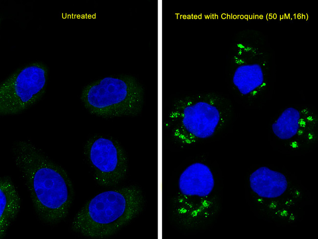 MAP1LC3A / LC3A Antibody - Immunofluorescence of U251 cells, using LC3 Antibody (APG8). U251 cells(right) were treated with Chloroquine (50 mu M,16h). The antibody was diluted at 1:25 dilution. Dylight Fluor 488-conjugated goat anti-mouse lgG at 1:400 dilution was used as the secondary antibody (green). DAPI was used to stain the cell nuclear (blue).