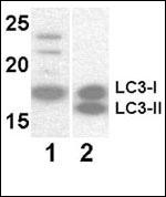 MAP1LC3A / LC3A Antibody - Western blot of anti-LC3 antibody at 8 ug/ml. Lane 1: Y79 (soluble fraction of cell extract); Lane 2: 293 transfected with human LC3 (whole cell extract).