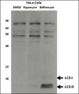 MAP1LC3A / LC3A Antibody - Western blot of anti-LC3 antibody HeLa cell lysates, which were treated with rapamycin or bafilomycin overnight. Data courtesy of Dr. David Rubinsztein, Cambridge Institute for Medical Research.