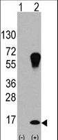 MAP1LC3A / LC3A Antibody - Western blot of LC3 (APG8a) (arrow) using purified antibody. 293 cell lysates (2 ug/lane) either nontransfected (Lane 1) or transiently transfected with the LC3 (APG8a) gene (Lane 2) (Origene Technologies).